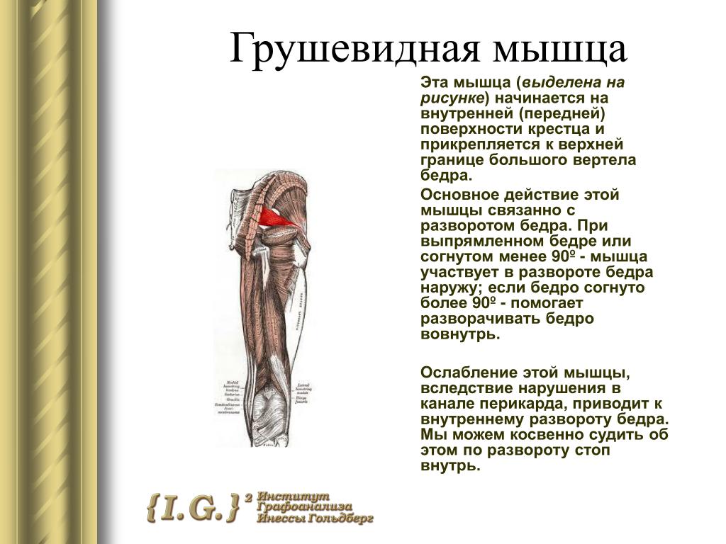 Синдром грушевидной мышцы картинки