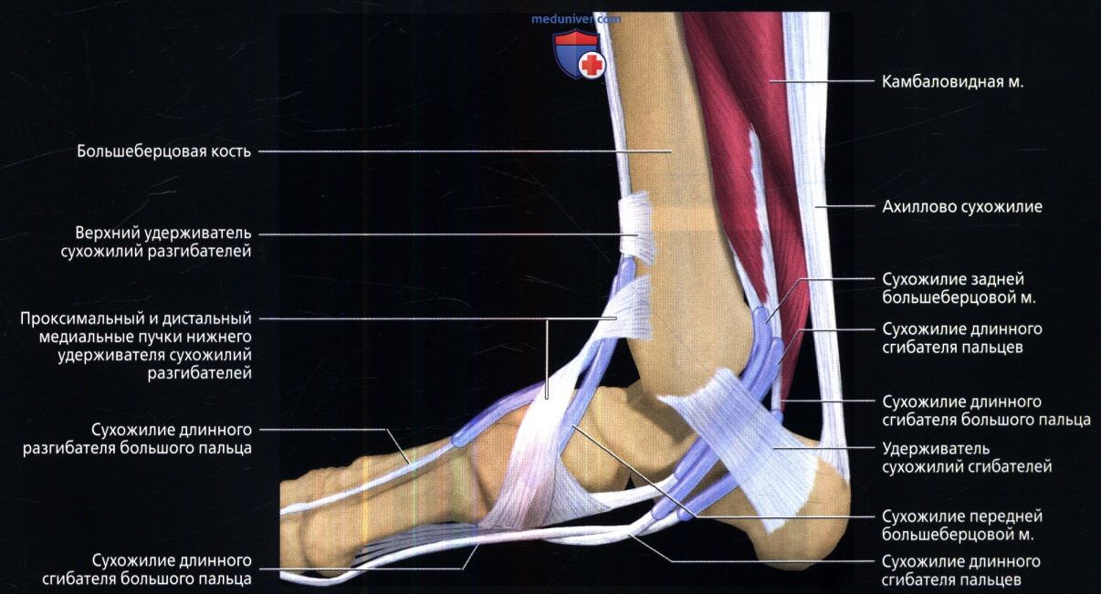 Повреждение малоберцовых связок. Тендинит сухожилия задней большеберцовой мышцы. Связки и сухожилия голеностопного сустава анатомия. Сухожилие задней большеберцовой мышцы. Удерживатели сухожилий голеностопного сустава.