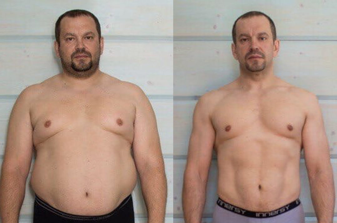 Лобковый жир у мужчин фото