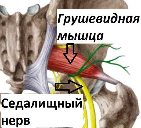 Грушевидная мышца воспаление симптомы лечение где находится фото у женщин