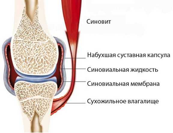 Где находится локоть у человека фото