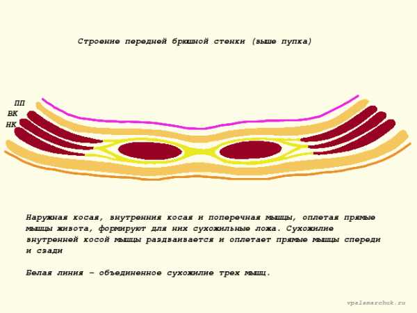 Диастаз 2 степени фото